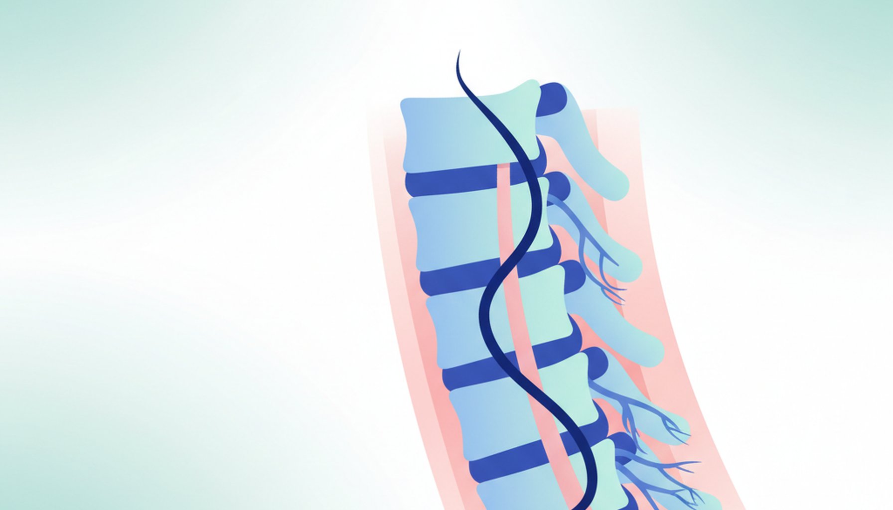 Anestesia Peridural: O Que e, Tecnica e Indicacoes