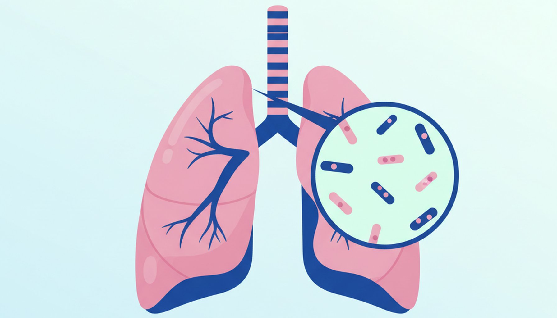 Tuberculose: Causas, Sintomas, Diagnostico e Tratamento
