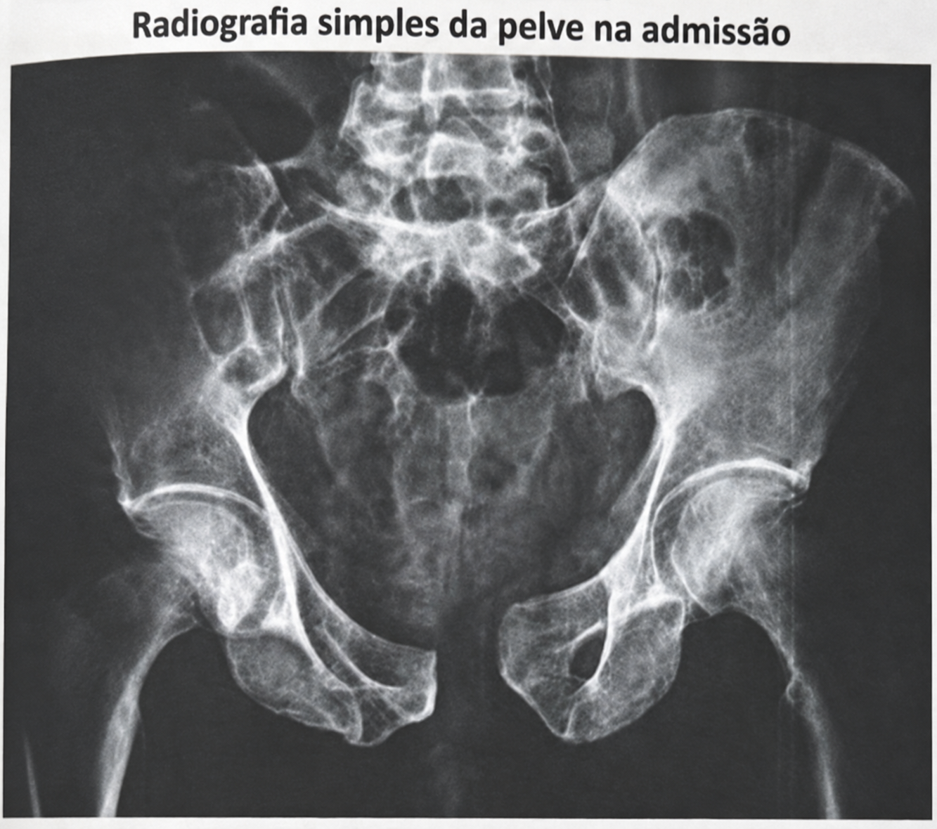 Imagem da questão de Trauma e Emergência