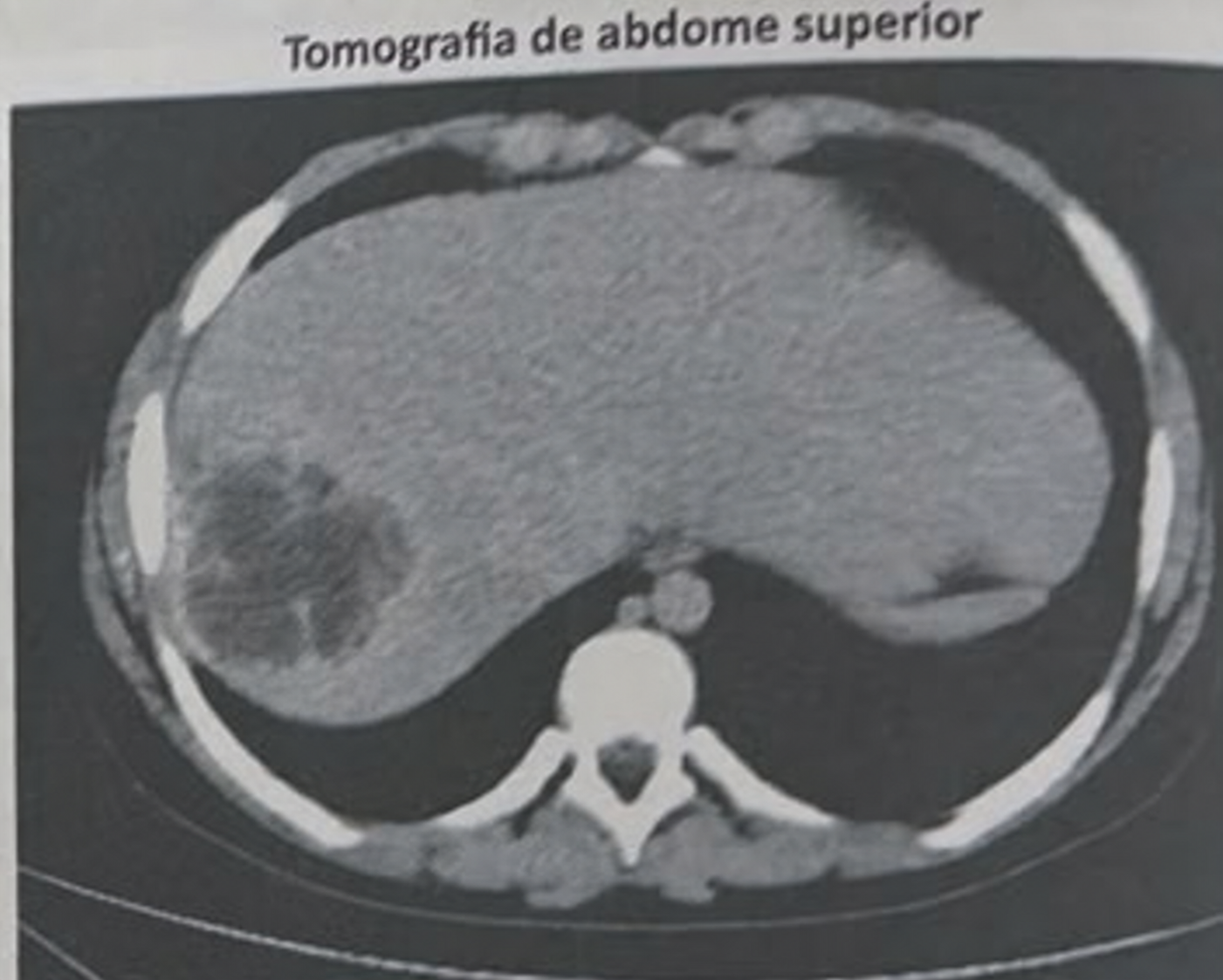 Imagem da questão de Hepatobiliar